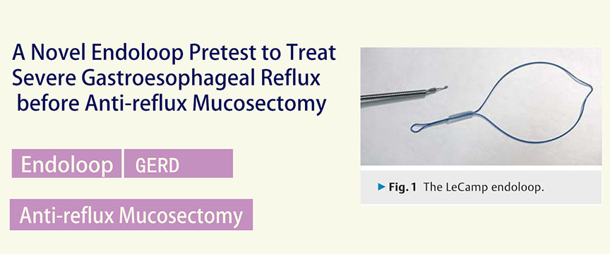 novel use of endoloop