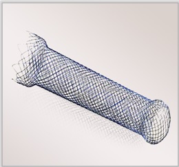 Stent Custermization Service