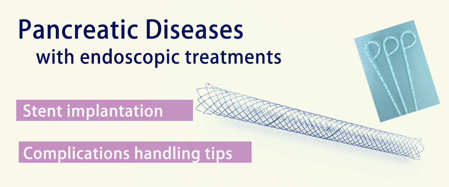 Pancreatic Diseases with Endoscopic Treatment