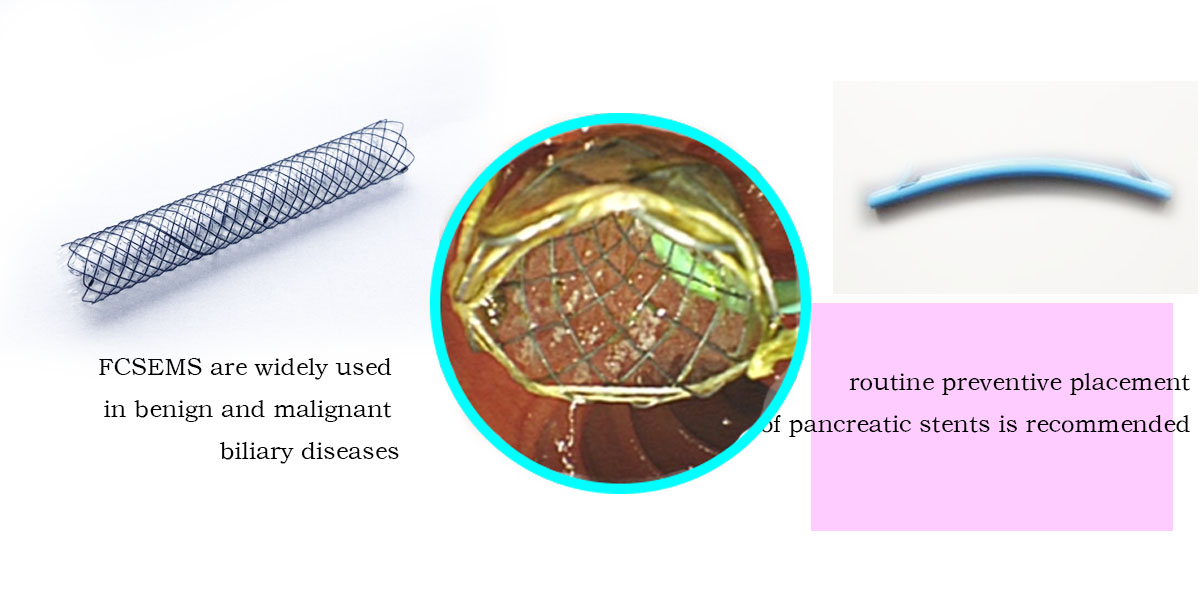 A multi-center retrospective study to systematically investigate the risk of pancreatitis caused by the placement of a fully covered metal stent across the duodenal papilla and its influencing factors